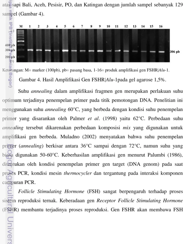 Gambar 4. Hasil Amplifikasi Gen FSHR|Alu-1pada gel agarose 1,5%. 