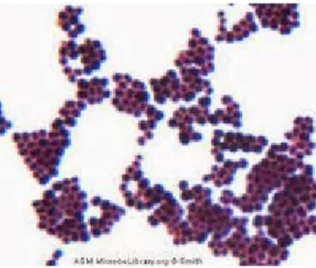Gambar   diatas   menunjukan   gambar   hasil   pewarnaan   gram   bakteri  St.   aureus  dibawah perbesaran   mikroskop