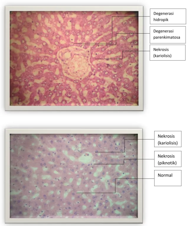 Foto preparat Gambar 1 Degenerasi  hidropik Degenerasi  parenkimatosa Nekrosis  (kariolisis) Nekrosis  (kariolisis) Nekrosis  (piknotik) Normal