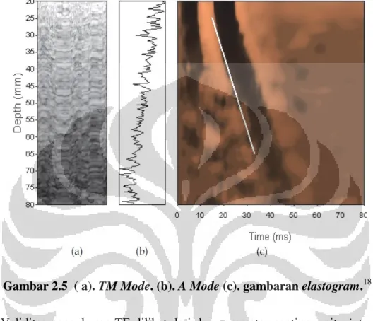 Gambar 2.5  ( a). TM Mode. (b). A Mode (c). gambaran elastogram. 18