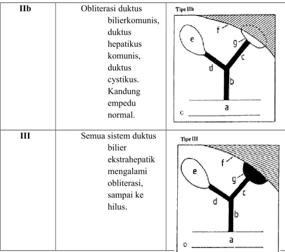 Gambar 3: Gambaran klasifikasi Atresia Bilier menurut Kasai.
