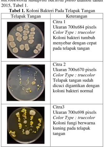 Tabel 1. Koloni Bakteri Pada Telapak Tangan  Telapak Tangan  Keterangan 
