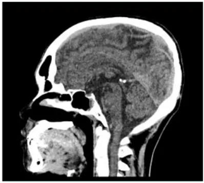 Gambar 3. Citra CT Kepala Sagital  2.1.2  Normalisasi 