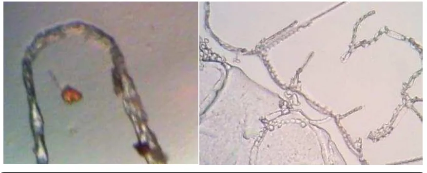 Figure 2. Microscope images of spores (left) and hyphae (right) of Phytophthora sp. 