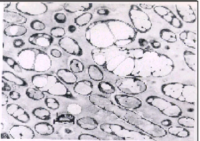 Gambar  2   Hasil scanning electron microscope  granula PHB pada  R. eutropha  (Sumber : http://che.kaist.ac.kr/~biosyst/research/pha/pha.html)