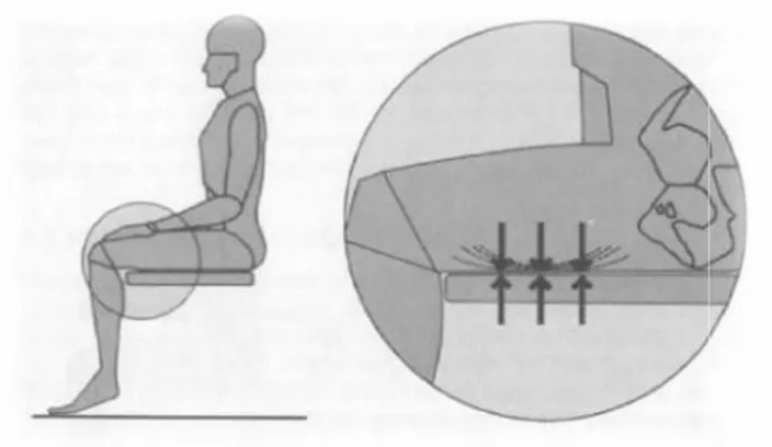 Gambar 2.4. Landasan tempat duduk yang terlalu tinggi dapat menyebabkan paha tertekan dan peredaran darah terhambat.