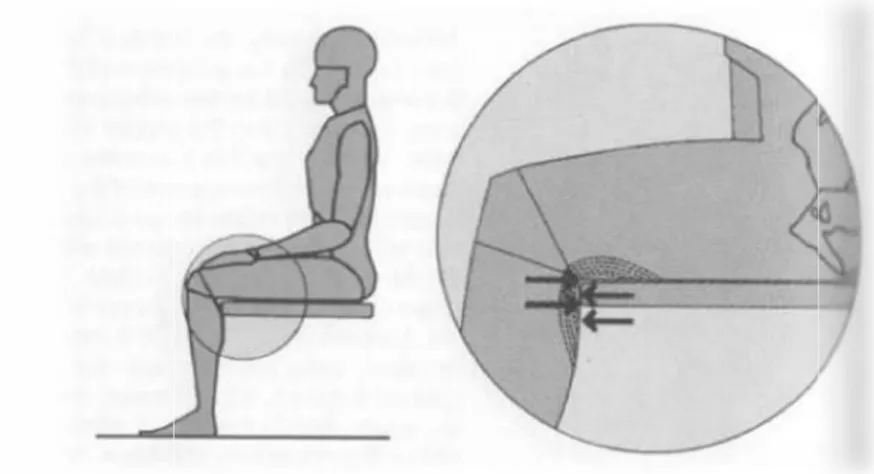 Gambar 2.6. Bila landasan tempat duduk terlalu lebar, bagian ujung dari landasan akan menekan daerah tepat dibelakang lutut