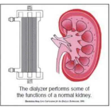 Gambar 2.4:  Dializer (artificial kidney) 
