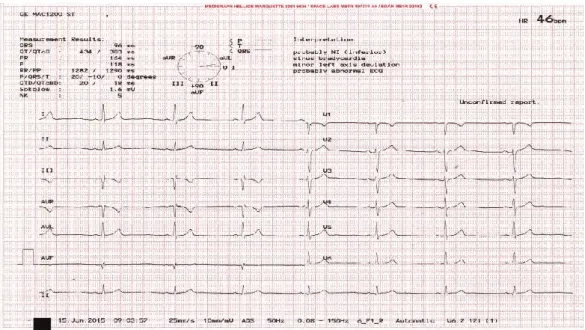Gambar 2. Hasil pemeriksaan Jantung dengan ECG 12-lead 