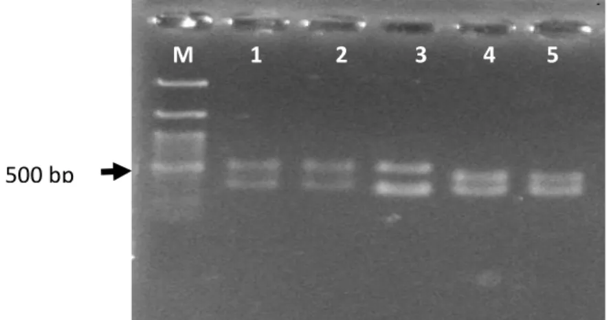 Gambar  7.  Panjang  IGS  Lactobacillus  sp  F213  (1,  2),  L.  rhamnosus  SKG34  (3)  dan  Pediococcus spp (4,5) 