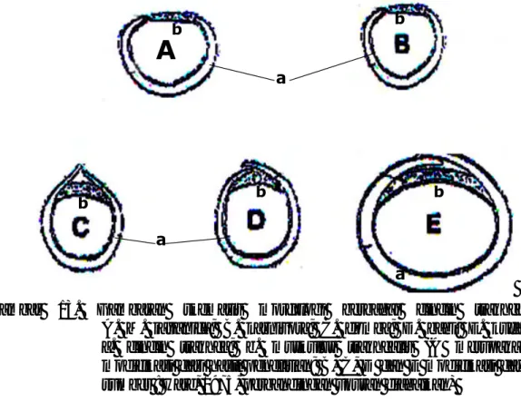 Gambar 13.  Gambaran skematis morfologi berbagai cincin trakhea.                        