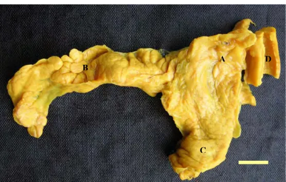 Gambar  4 Organ pankreas trenggiling (M. javanica). Bagian-bagian pankreas trenggiling terdiri atas  bagian head terletak di kaudal lambung (A), bagian dorsal merupakan bagian yang paling panjang tetapi sempit (B), dan bagian ventral merupakan bagian yang 