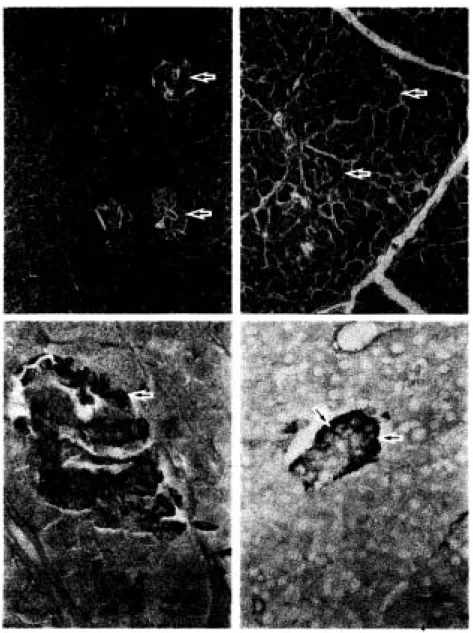 Gambar  1.  Fotomikrograf  pankreas  kambing  (A,C) dan  domba  (B,D).  Pankreas domba  (B)  mempunyai  lobulasi  yang  lebih  jelas daripada  pankreas kambing (A), ditandai  dengan septa interlobular  yang lebih  nyata