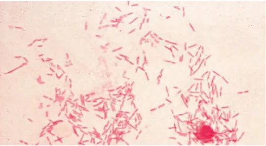 Gambar 5. Escherichia coli pewarnaan gram (500x)  Sumber : Prescott, 2002. 