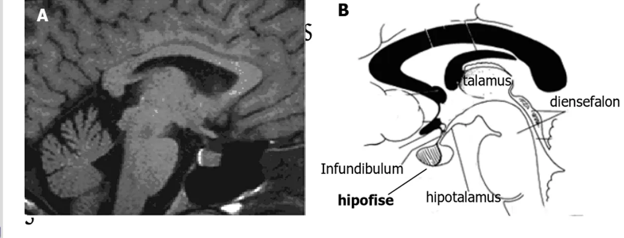 Gambar 2 Magnetic resonance image (MRI)  hipotalamus  dan  hipofise  manusia.             