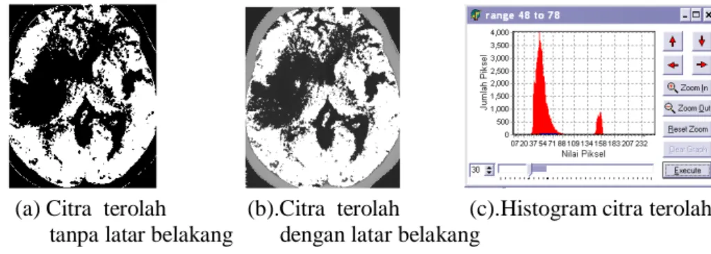 Gambar 7. Citra Hasil Terolah Histogram Classify   Hasil Uji Region of Interest (ROI) 