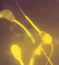 Gambar 3.1.  Gambaran spermatozoa yang belum kapasitasi, Kapasitasi dan  setelah reaksi akrosom pada sapi (Susilawati, 2000)