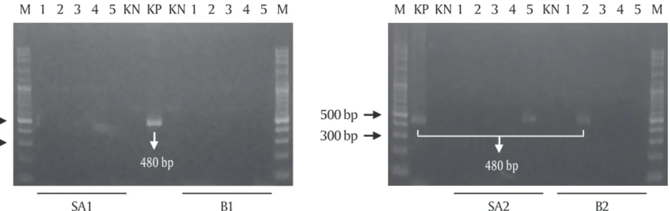 Gambar 1. Deteksi transgen krt-GP11 pada empat garis keturunan (line) larva transgenik F 1 
