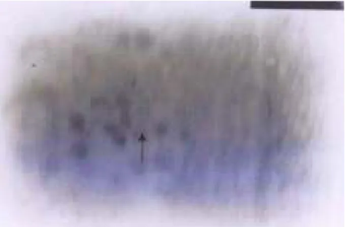 Gambar  1.  Hasil  Transmission  electron  microscope  (TEM)  dari  insang  ikan  koi  yang  terinfeksi  oleh  KHV