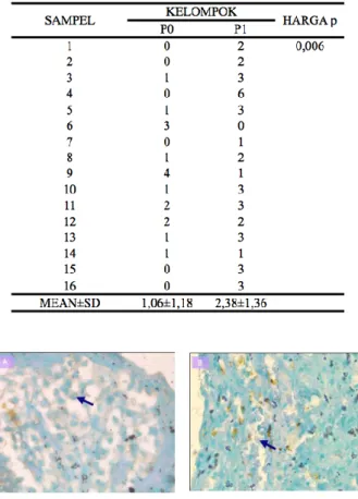 Gambar  1.  Perbandingan  ekspresi  Bcl-2  (panah)  antara  kelompok  P0  (slide  A)  dengan  kelompok  P1  (slide  B)