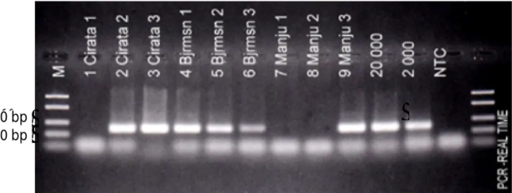 Figure 4. Agarose  Gel  profile  amplificated  SYBR  Green  Real-Time  by  using  primers  molecular target  290  bp