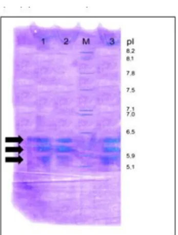 Gambar 3. Hasil IEF gel elektroforesis Protein 100 kDa  