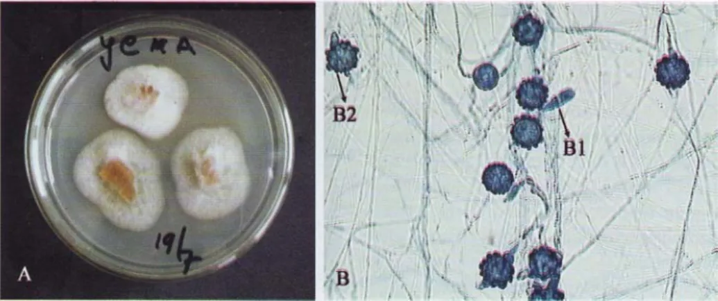 Gambar 1. Duddingtonia flagrans pada  media  potato dextrose agar (A); pengamatan mikroskopik perbesaran  400 x dan pewarnaan laktofenol biru (B);