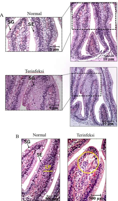 Gambar 2 Histologi intestinum ikan nila terinfeksi parasit. A) Lapisan mukosa mengalami  perluasan