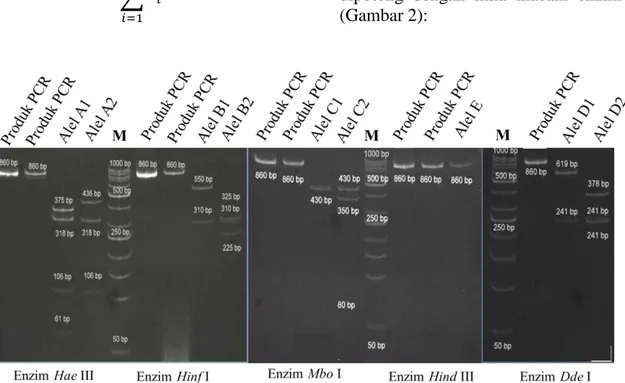 Gambar 2. Hasil Pemotongan Produk PCR pada gel PAGE 10%. Keterangan. M: 50 bp Ladder ; Angka  pada gambar: panjang fragmen (bp)