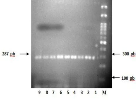 Gambar 1. Hasil amplifikasi Gen CVM pada mesin PCR, M: marker 100 bp; 1-5: 