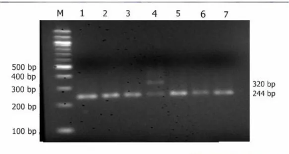 Gambar  1.  Hasil  amplifikasi  dan  identifikasi    Gen  FXID  pada  mesin  PCR,  M: 