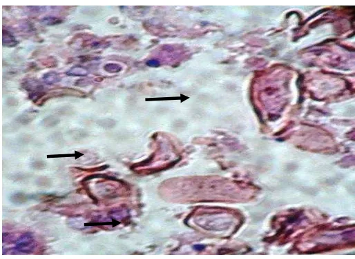 Figure 3. Histopathological examination of the coccidiosis infection. Arrow show bile ducts undergo hypertrophy