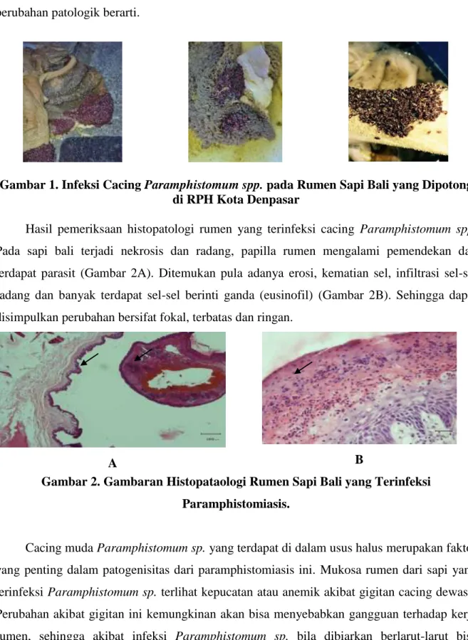 Gambar 1. Infeksi Cacing Paramphistomum spp. pada Rumen Sapi Bali yang Dipotong  di RPH Kota Denpasar 