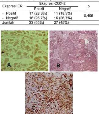 Tabel 3. Hubungan Ekspresi COX-2 dengan ER pada  invasive carcinoma NST payudara 