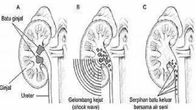 Gambar 1 : penampang interior ginjal Keterangan :