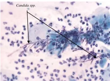 Gambar 12. Candida spp.  (kanan) (Nayar,2004) 