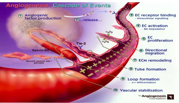 Gambar 1. Angiogenesis: Cascade of Events (dikutip dari daftar pustaka  17 ) 