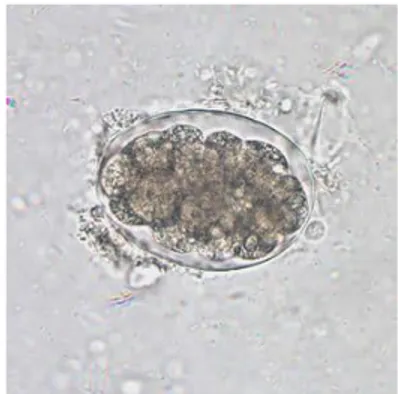 Gambar 5. Telur cacing tambang (hookworm) (CDC, 2010)