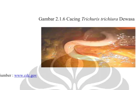 Gambar 2.1.6 Cacing Trichuris trichiura Dewasa 