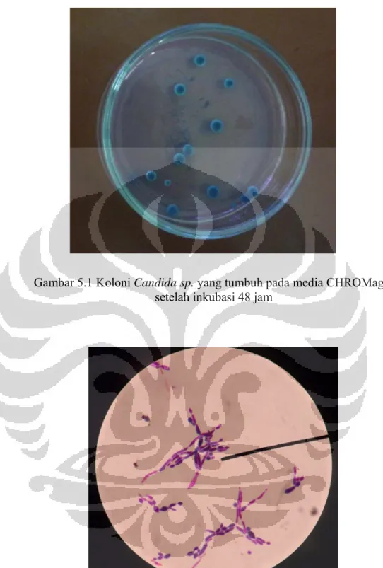 Gambar 5.1 Koloni Candida sp. yang tumbuh pada media CHROMagar  setelah inkubasi 48 jam 