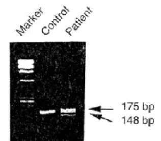Gambar 2.5. PCR gen protein Band 3 pada pasien ovalocytosis