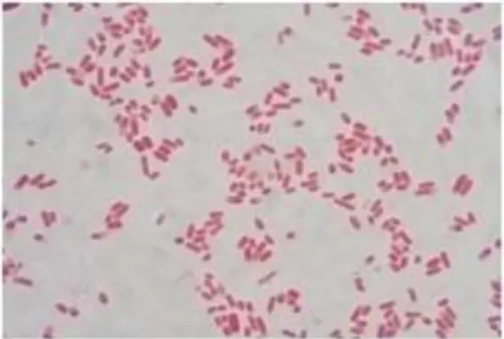 Gambar 1. Bakteri Escherichia coli Pada Pengecatan Gram  Klasifikasi bakteri Escherichia coli yaitu: 16