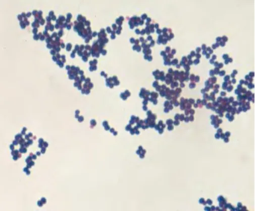 Gambar 2  Staphylococcus aureus. Pewarnaan Gram. 