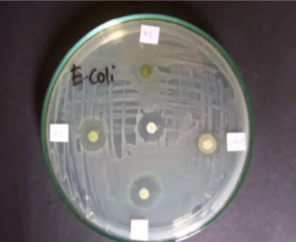 Gambar 2. Zona bebas kuman berbagai perlakuan  terhadap kultur Escherichia coli 