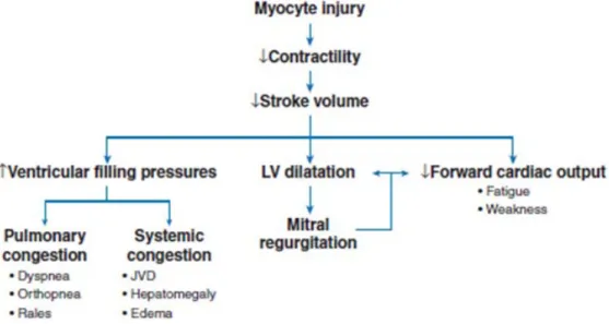Gambar 2. Patofisiologi Kardiomiopati dilatasi. Dikutip dari (3)  Penurunan stroke volume karena 