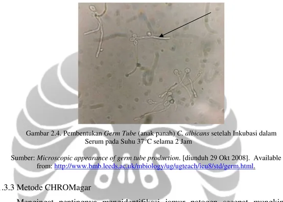 Gambar 2.4. Pembentukan Germ Tube (anak panah) C. albicans setelah Inkubasi dalam  Serum pada Suhu 37°C selama 2 Jam 