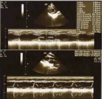 Gambar 4. Hasil Echocardiogram