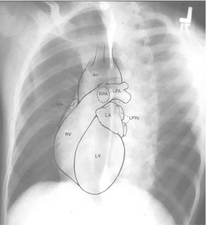 Gambar 3.  Ruang ruang jantung pada foto left anterior oblique 