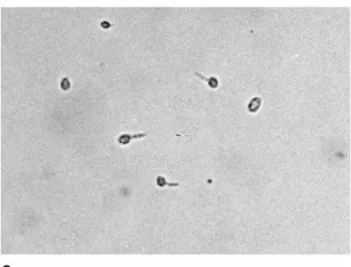 Gambar 2.1.Candida albicans. A: Blastokonidia (blastospora) dan pseudohifa dalam  eksudat