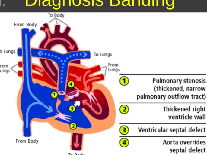 Diagram skematik  TOF 